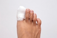 Why You Should Never Ignore Any Fracture in Your Toe