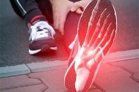 What to Do After a Stress Fracture
