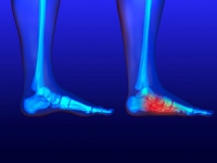 How to Notice Flat Feet